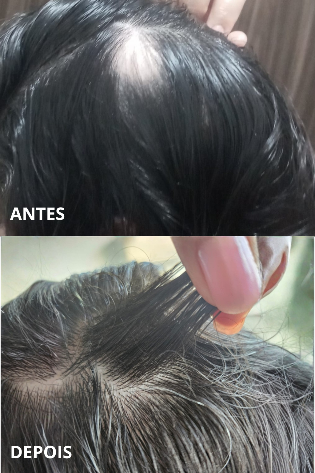 Tônico Crescimento Capilar Poderoso - Envio Imediato Umect Hair